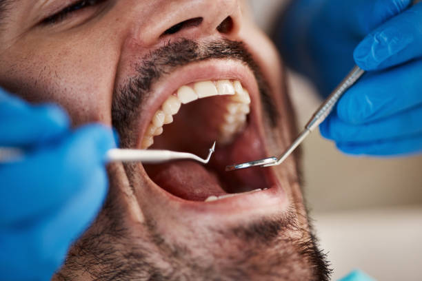 Best Emergency Treatment for Dental Infections or Abscesses in Caribou, ME