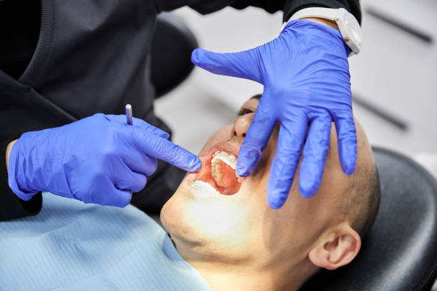 Best Emergency Dental Care for Broken or Chipped Teeth in Caribou, ME